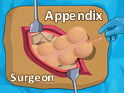 Appendix Surgeon