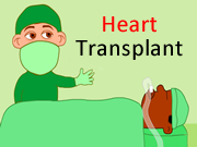 Heart Transplant