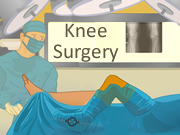 Knee Surgery