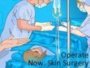 Operate Now: Skin Surgery