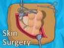 Skin Surgery